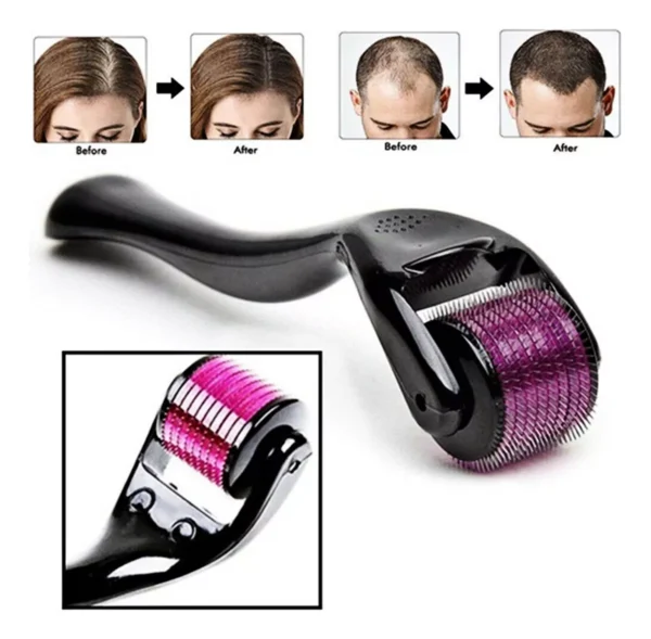 Dermaroller 540 Agulhas Microagulhamento Barba e Cabelo