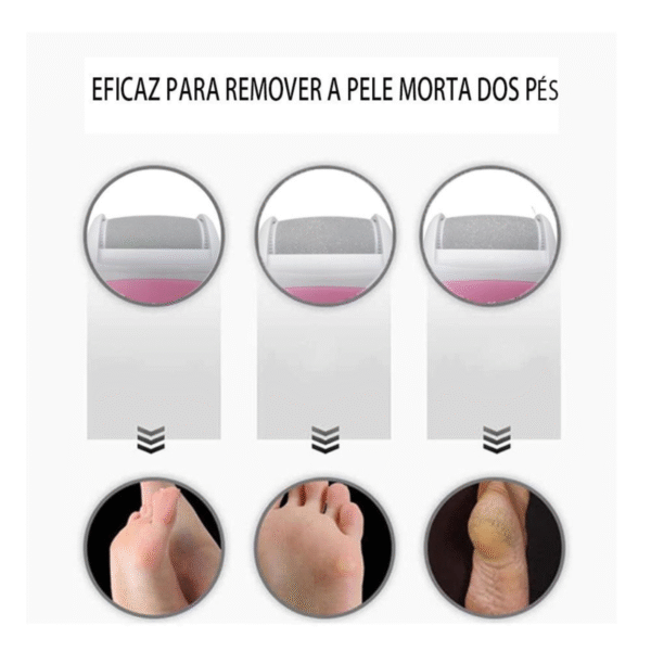 Lixa Elétrica Recarregável 3 em 1 Pés e Calos ND8001